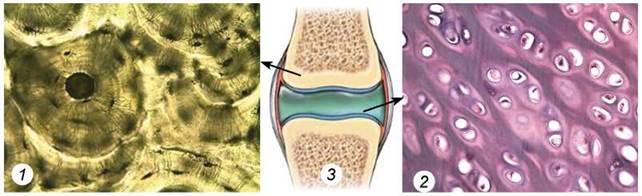 Функция хрящевой и костной ткани. Костная соединительная ткань. Костная и хрящевая ткань гистология. Скелетные хрящевые костные ткани. Скелетная хрящевая ткань.